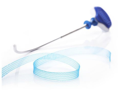 Female Mid-Urethral Sling