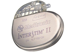 Interstim Implantation